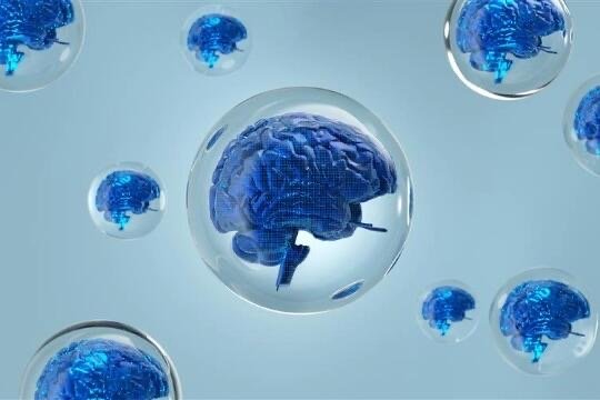Top of Mind: AI: in a bubble?
